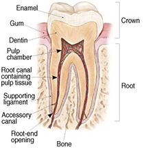 root canals explained 1
